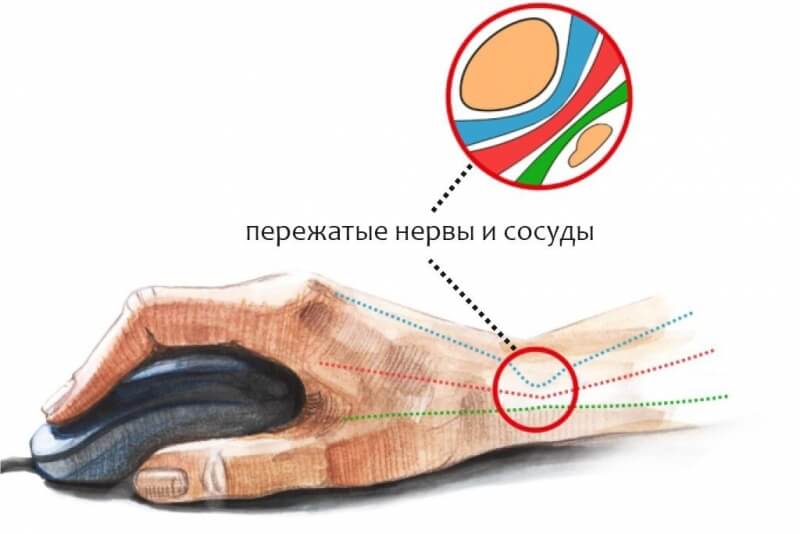 Что вместо гидры